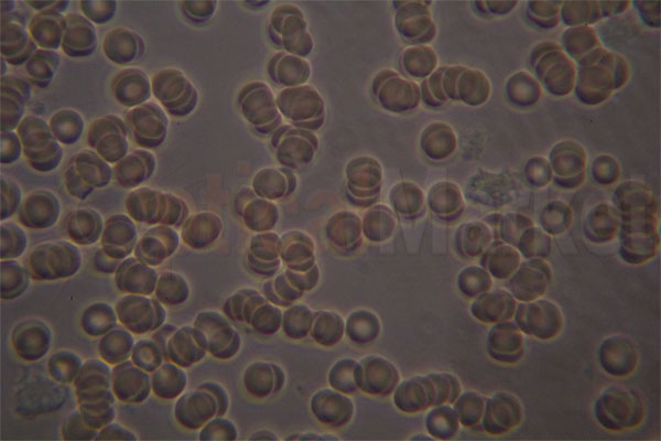 Кровь под микроскопом Фазовый контраст
